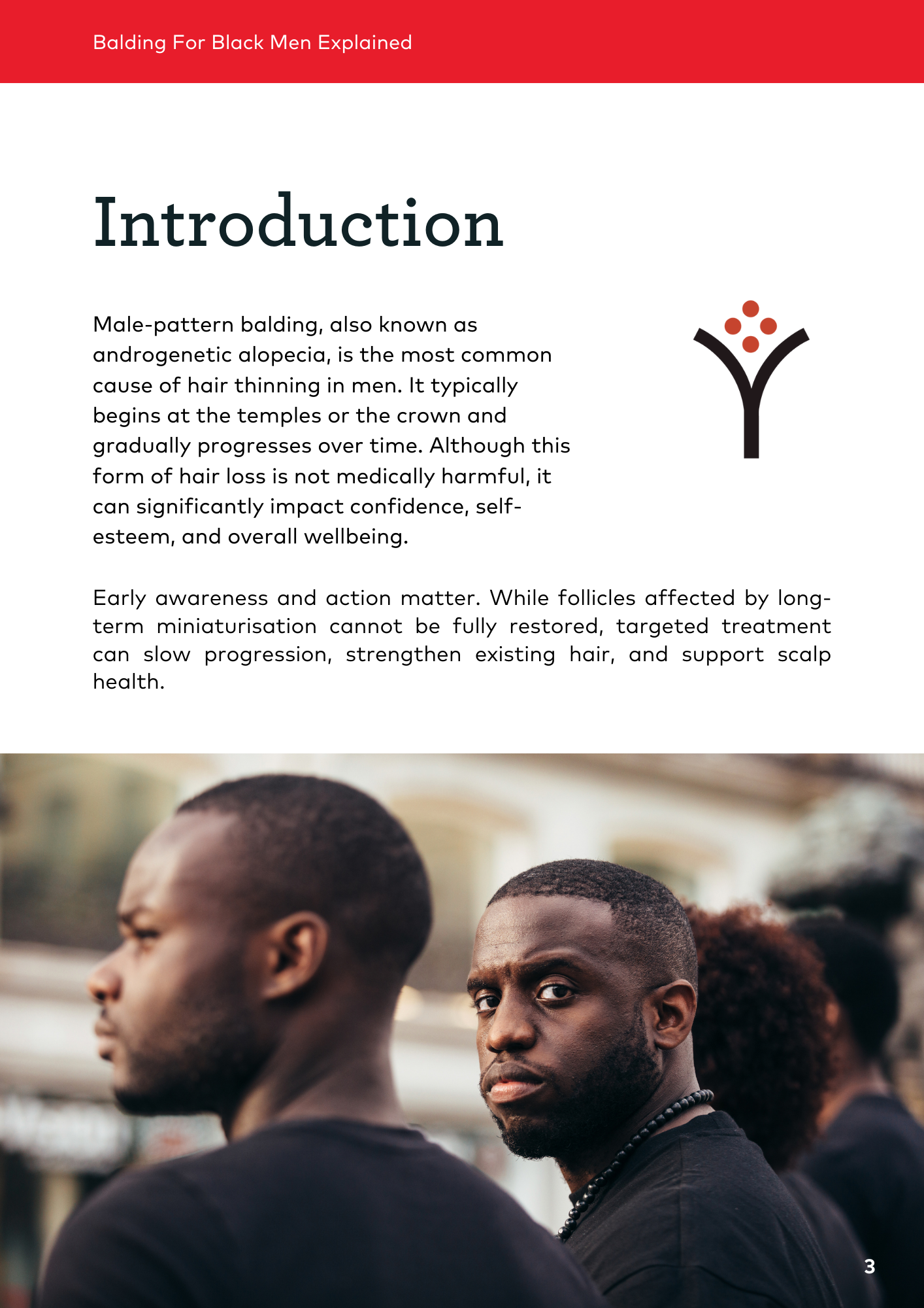 Balding for Black Men Explained