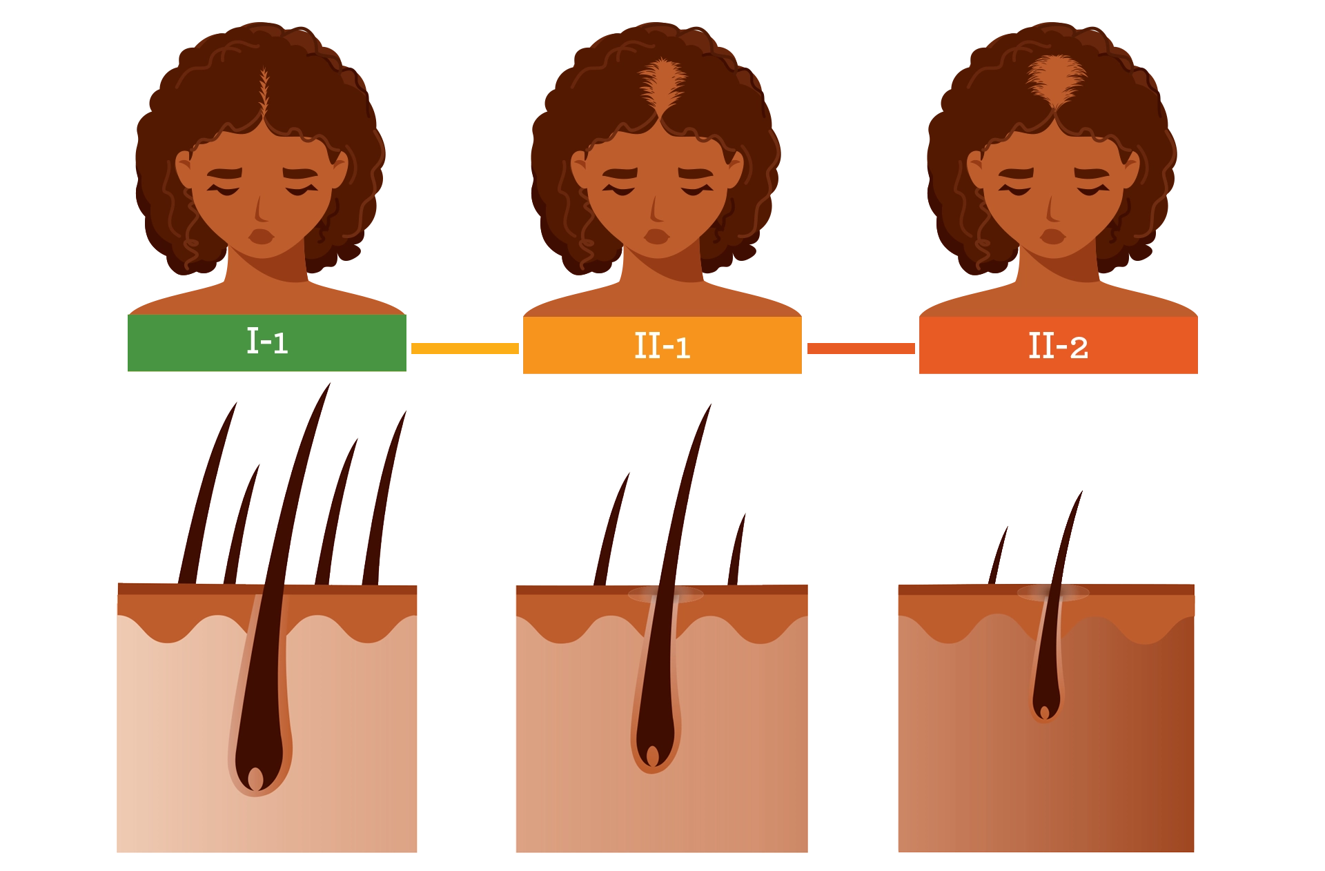 Infographic showing hair loss and regrowth information
