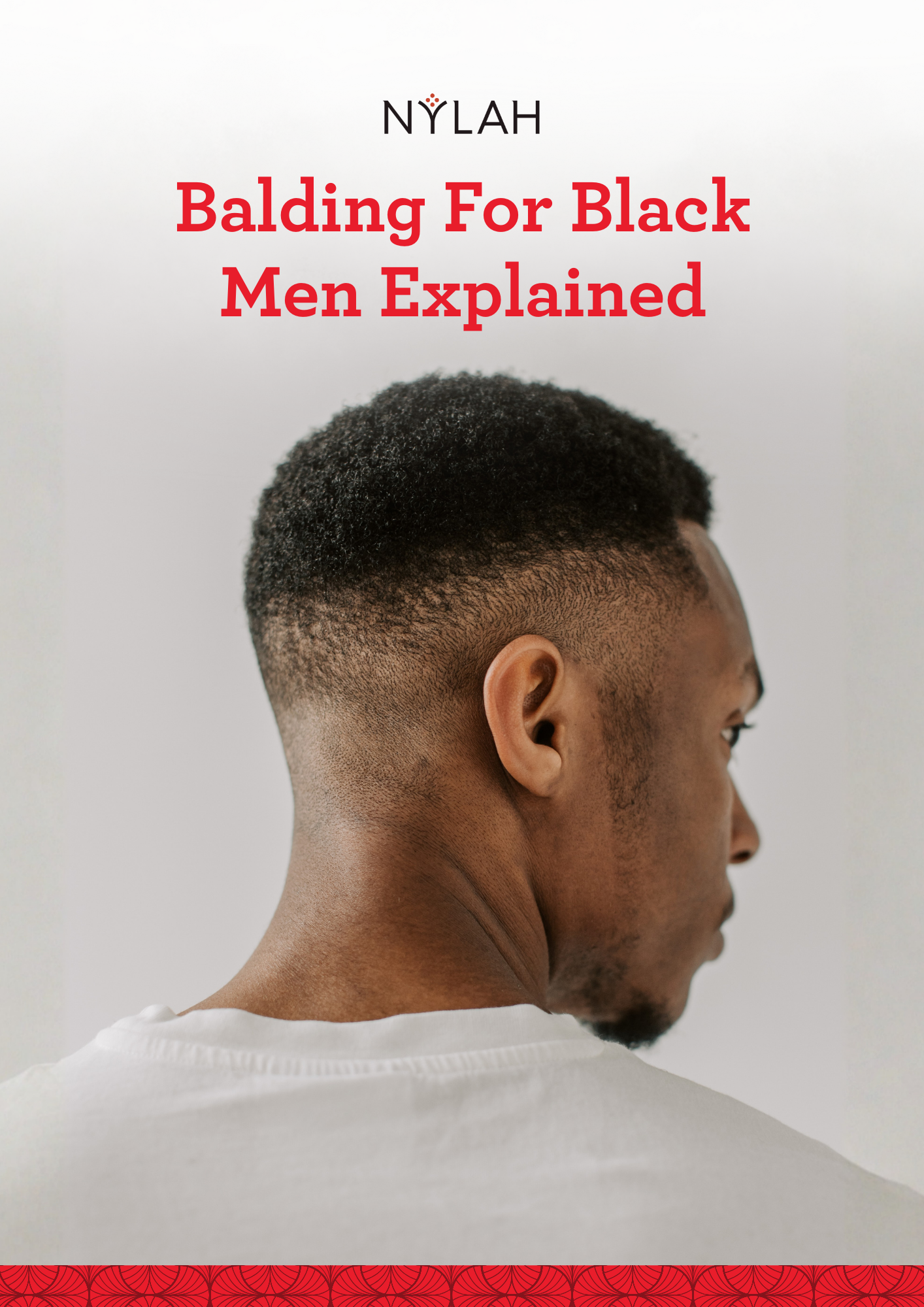 Balding for Black Men Explained