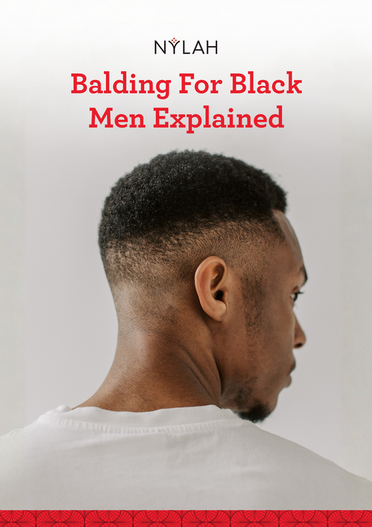 Balding for Black Men Explained