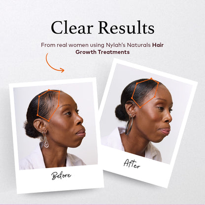 Flourish Intelligent Hair Growth Serum