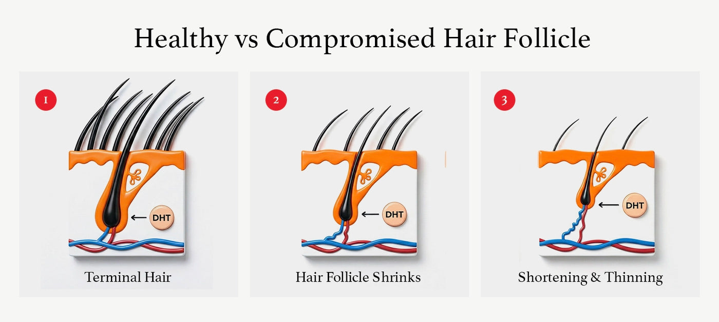 Diagram of healthy vs compromised hair follicle
