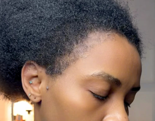 After - Onyi