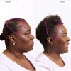 90-Day All-in-One Flourish Hair Growth Kit