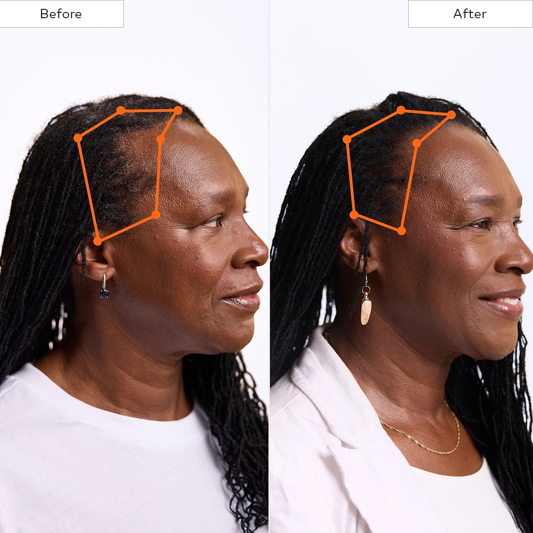 Before and After hair growth