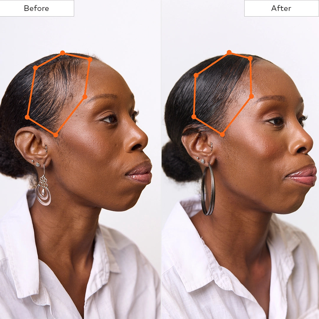 Before and After hair growth