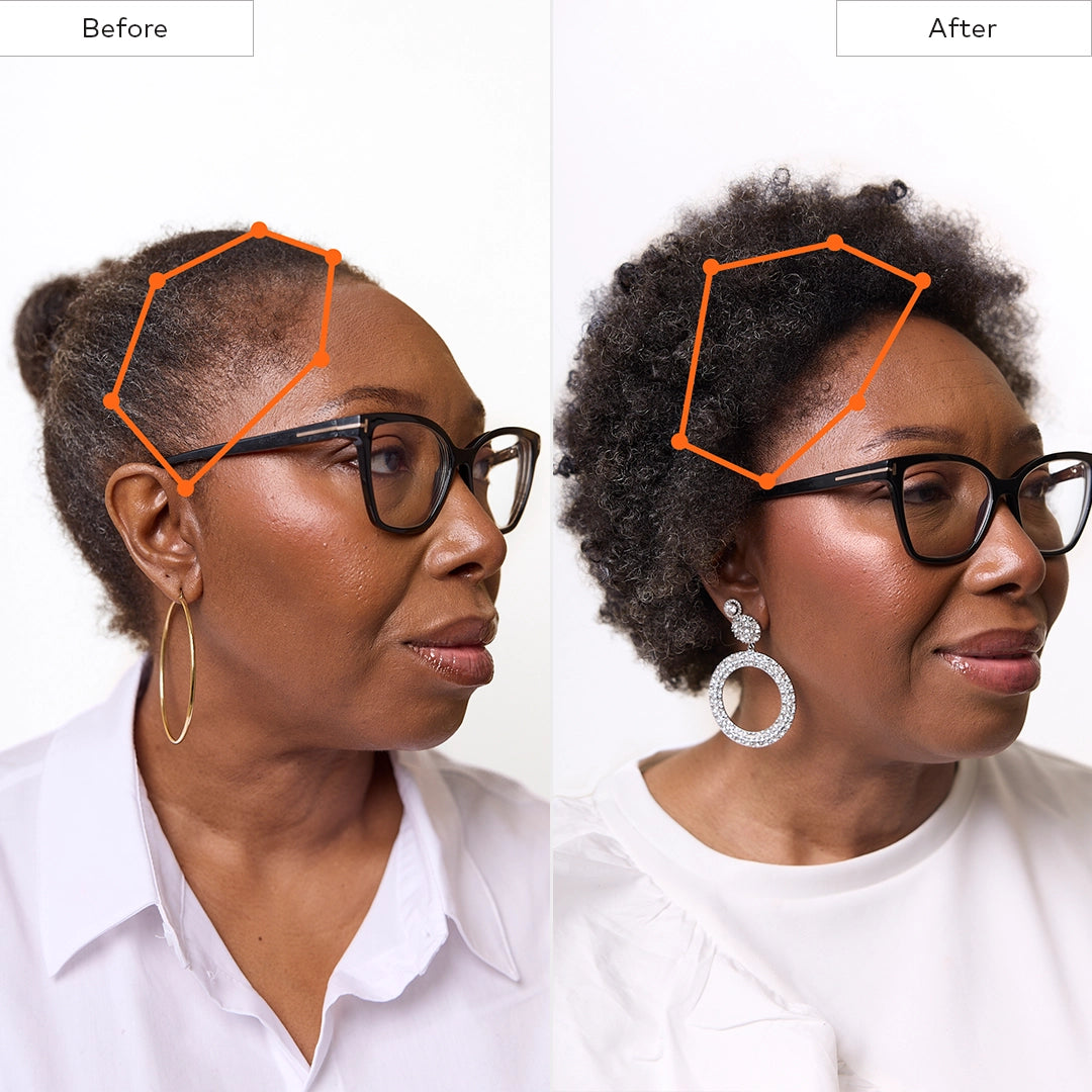 Before and After hair growth