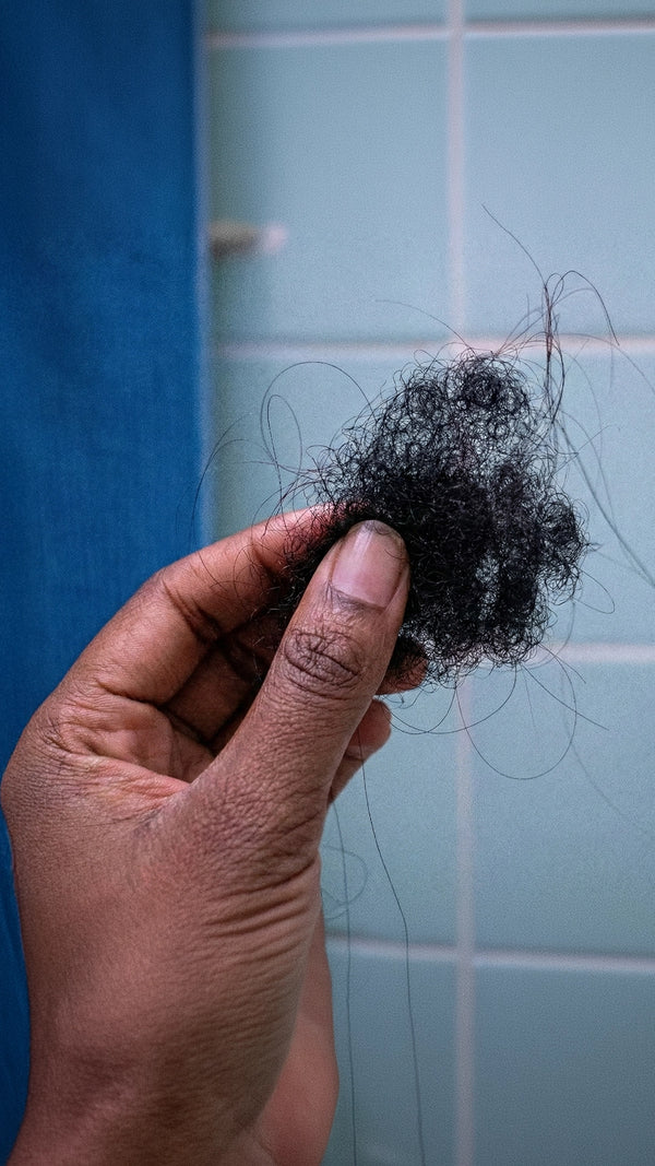 Excessive Shedding