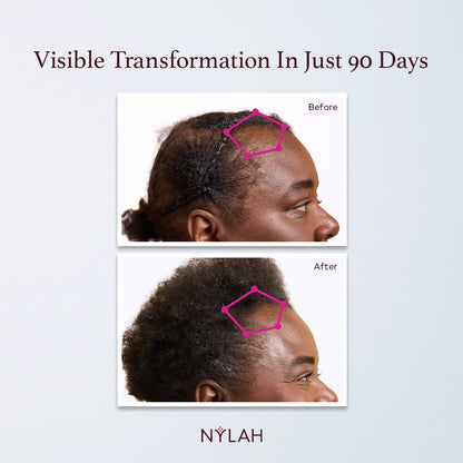 Flourish Intelligent Hair Growth Serum