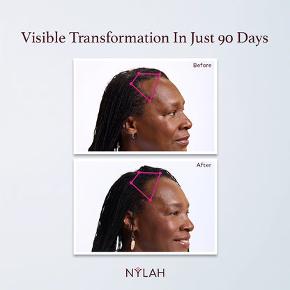 Flourish Intelligent Hair Growth Serum