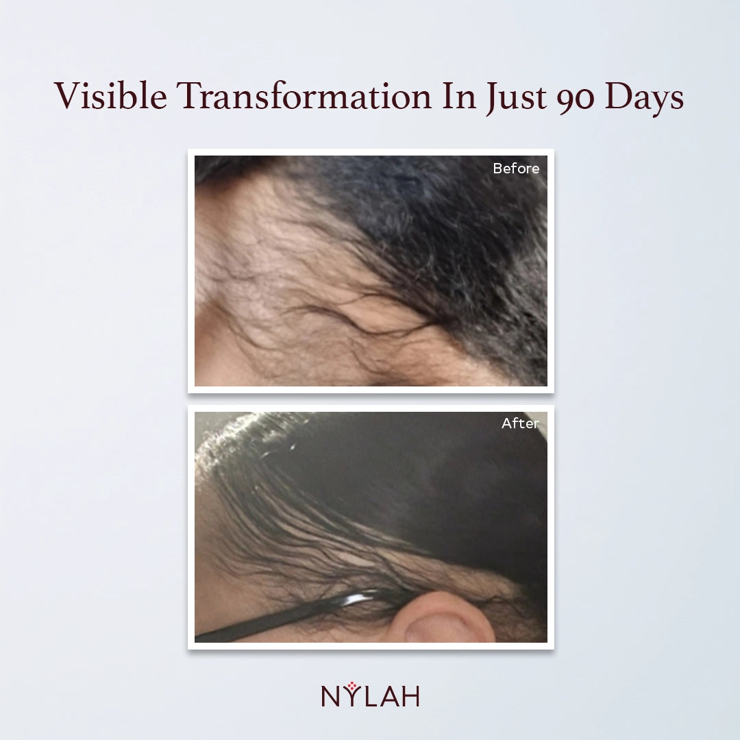 Flourish Intelligent Hair Growth Serum