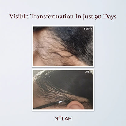 Flourish Intelligent Hair Growth Serum