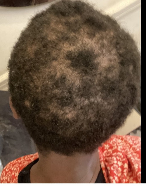 Before - A. Watkins