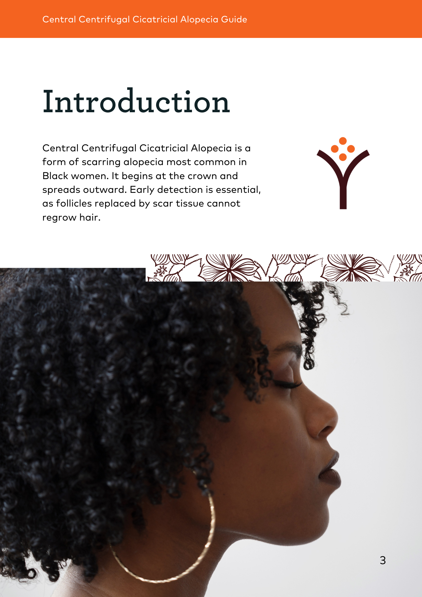 Introduction - Central Centrifugal Cicatricial Alopecia is a form of scarring alopecia most common in Black women. It begins at the crown and spreads outward. Early detection is essential, as follicles replaced by scar tissue cannot regrow hair. 